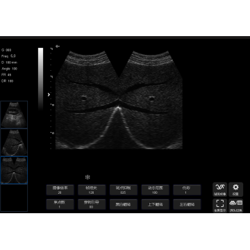 Sonostar SS-6B Ultrasound Machine meilleure que SS-7